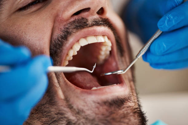 Best Pediatric Emergency Dentist in Coquille, OR